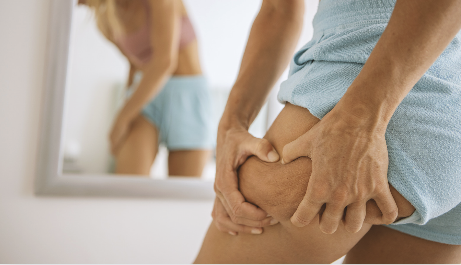 Cellulitkezelés előtt és után_vitalform Cellulitkezelés előtt és után