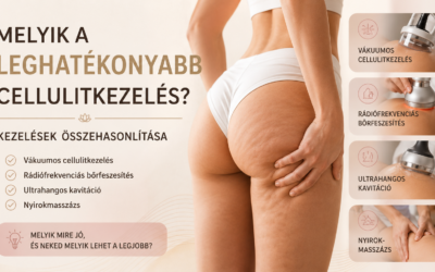 Melyik a leghatékonyabb cellulitkezelés? – Kezelések összehasonlítása